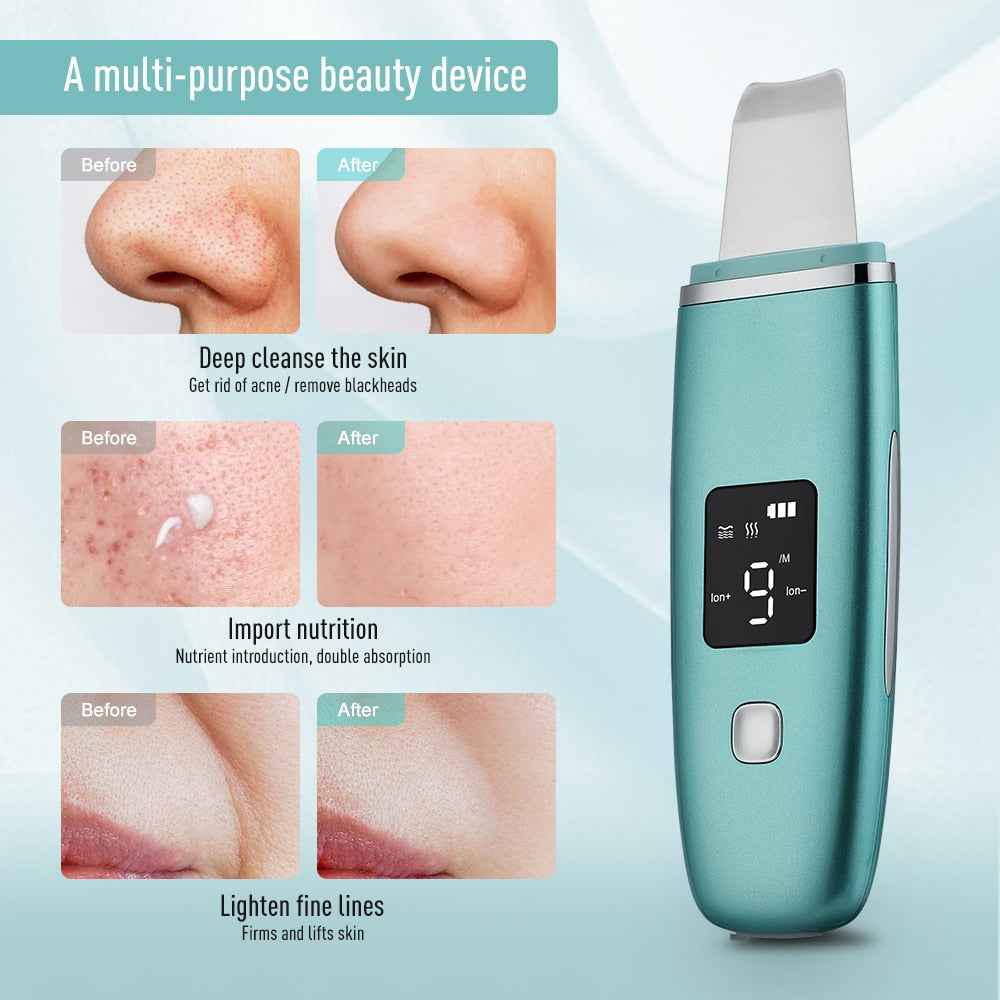 Skintera Ultrasonic Skin Scrubber with Ion Cleansing and Charging Base - Skintera