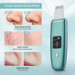 Skintera Ultrasonic Skin Scrubber with Ion Cleansing and Charging Base - Skintera