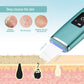 Skintera Ultrasonic Skin Scrubber with Ion Cleansing and Charging Base - Skintera